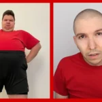Nikocado Avocado before and after weight loss transformation
