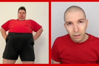 Nikocado Avocado before and after weight loss transformation